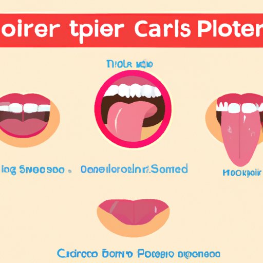 Tips for Managing Pain and Discomfort of Canker Sores on Tongue