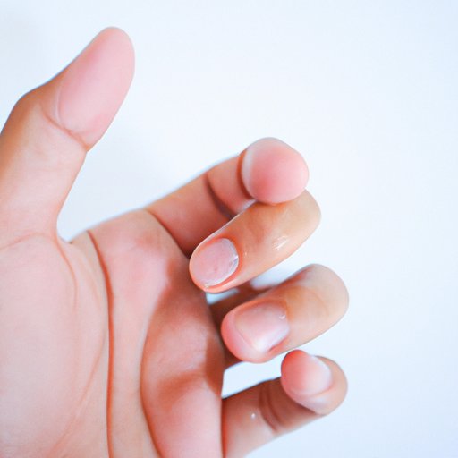 Symptoms of a Broken or Sprained Finger