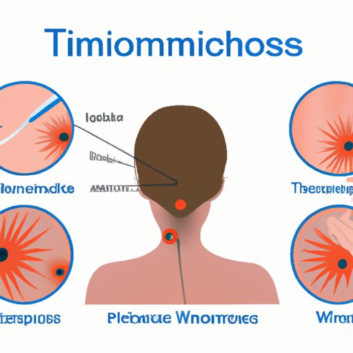 Trichomoniasis Symptoms: A Comprehensive Overview of the Infection