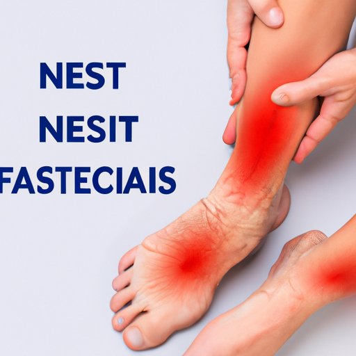 Necrotizing Fasciitis Symptoms: What You Need to Know to Protect Yourself